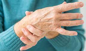 Healing of Arthritis and Carpal Tunnel Syndrome